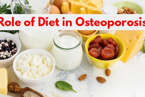 Role-of-Diet-in-Osteoporosis