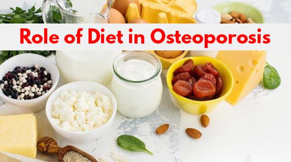 Role-of-Diet-in-Osteoporosis